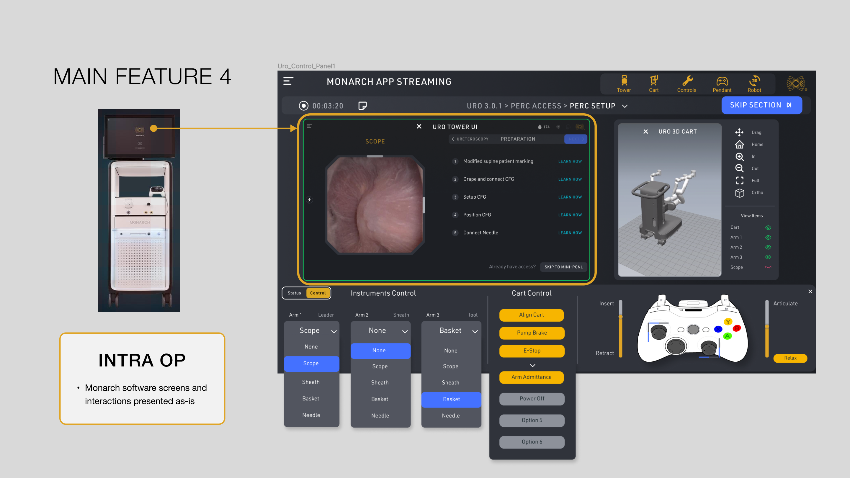 Redesigned-Features-4_-IntraOp